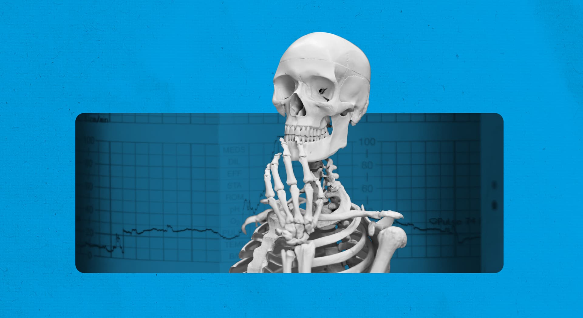 A skeleton appears on a blue background. A medical chart appears behind the skeleton. A skeleton appears on a blue background. A medical chart appears behind the skeleton.